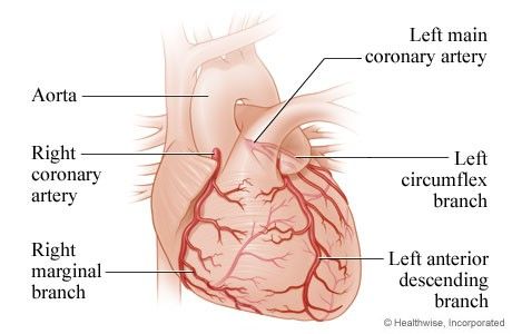 Coronary arteries. The left main divides into the left anterior descending and the left circumflex; the right coronary artery gives off the right marginal branch.