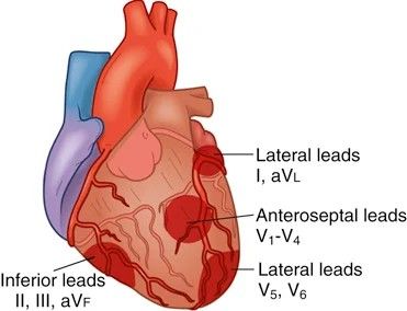 Which leads look at which wall of the left ventricle.