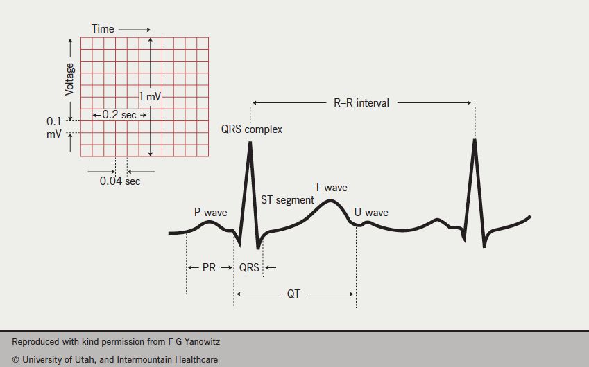 EKG paper. The small box is 0.04 second; the large box is 0.20 second. Vertically, 10 mm equals 1 mV.