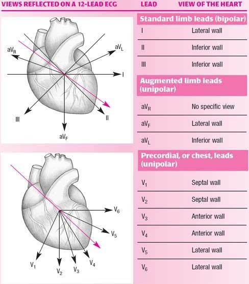 Which lead views which wall of the heart — the reference table behind every infarct-location question.