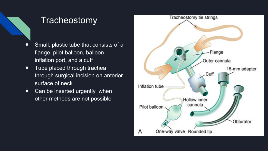Her labelled tracheostomy tube: flange, outer and inner cannula, obturator, cuff, pilot balloon. The inner cannula is the part you remove and clean; the obturator is the guide used to insert the tube.